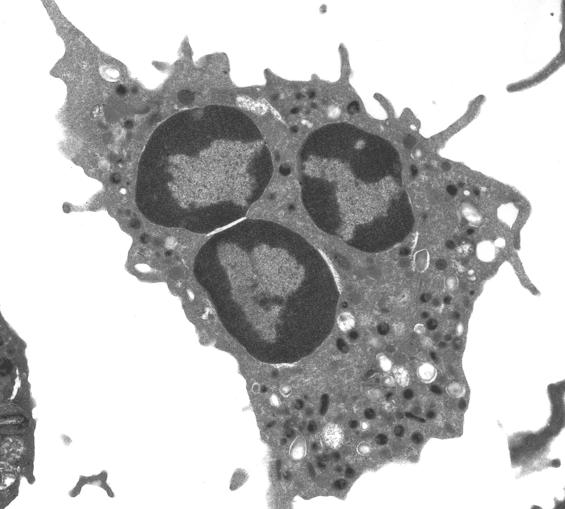A greyscale transmission electron micrograph of a neutrophil, showing the multi-lobed nucleus that identifies the cell type.