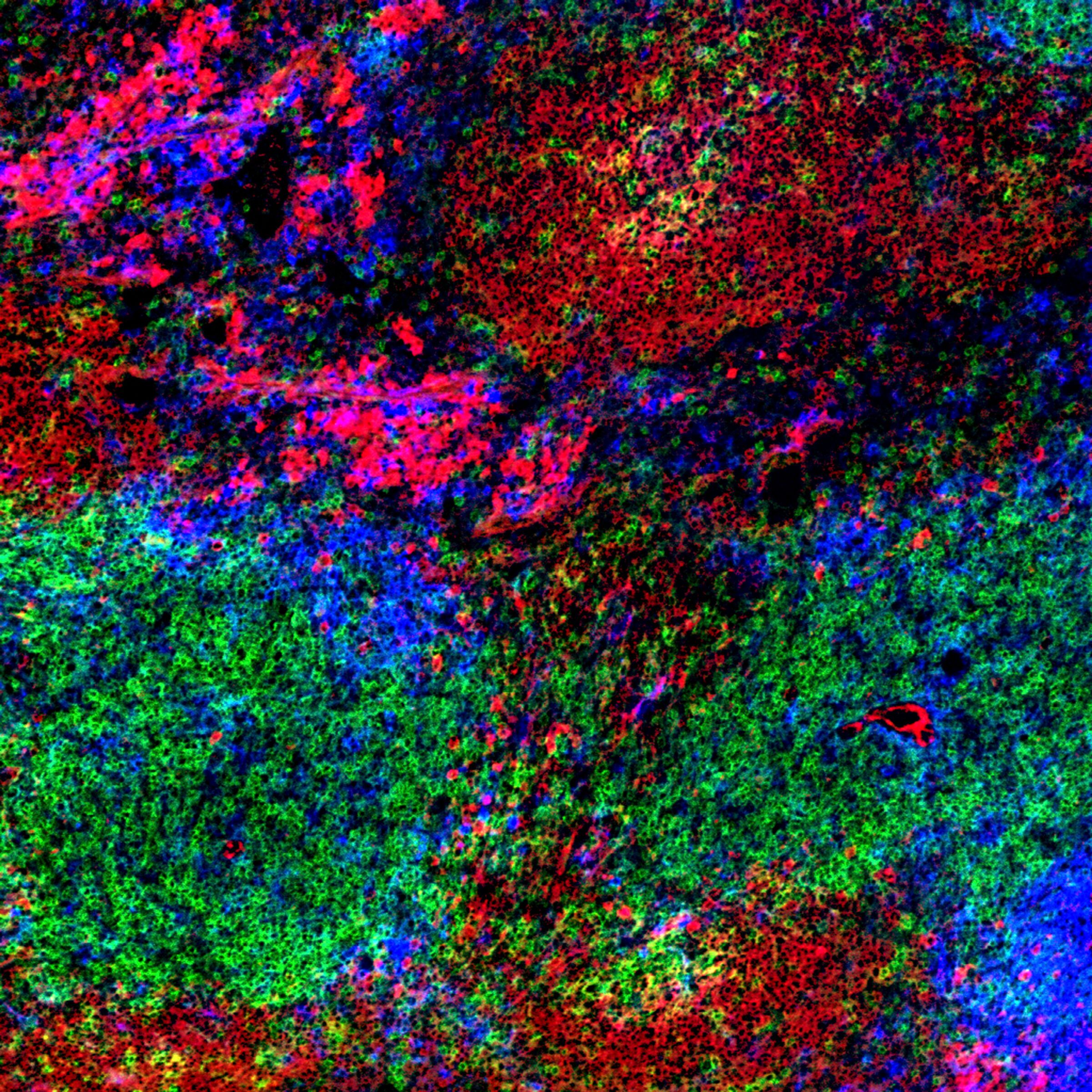 A dense fluorescence micrograph of spleen tissue three days after immunisation, with cells labelled in red, green and blue filling the whole frame.